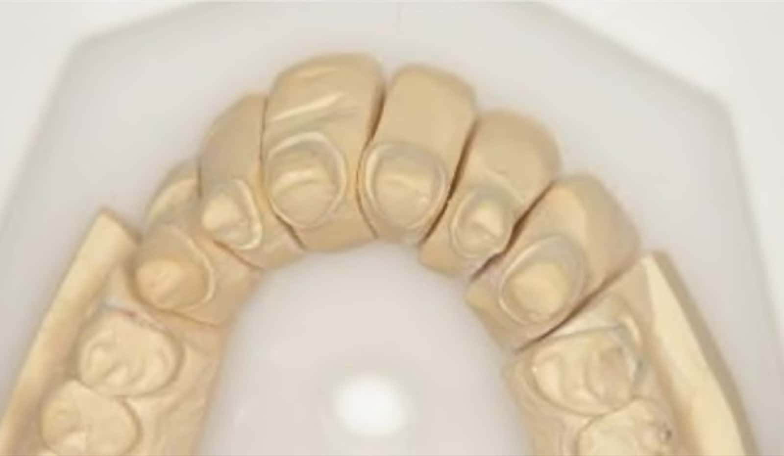Full-mouth rehabilitation — the work